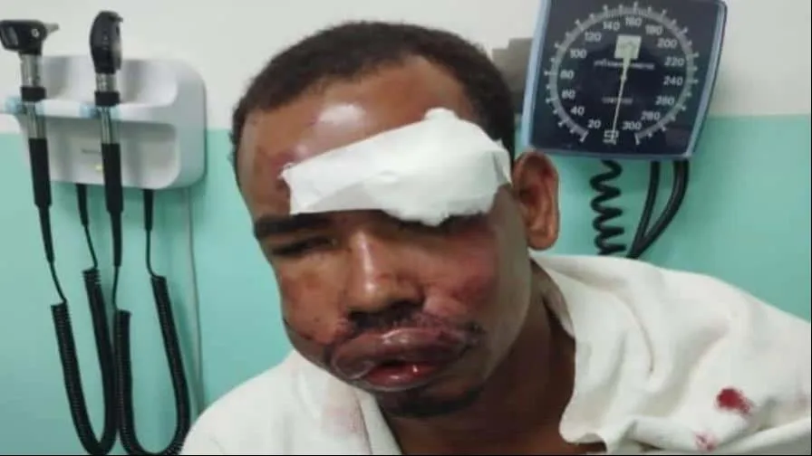 crop-w575-h383-herido-focus-0-0-896-504